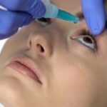 Khô Mắt – Căn Bệnh Thời Đại Công Nghệ Bạn Không Nên Bỏ Qua